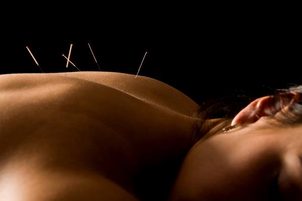 acupuncture-banner-small.jpg