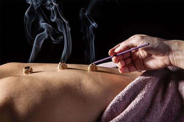 moxibustion-cones-moxa-treatment-points-top-needles-SMALL.jpg